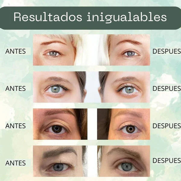 💖 LIFTING™️Cinta levanta párpados en instantes 192 unidades, envio gratis