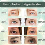 💖 LIFTING™️Cinta levanta párpados en instantes 192 unidades, envio gratis